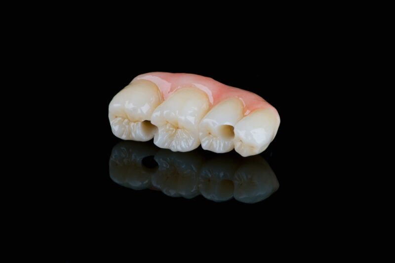 Dental Bridges Sandy
